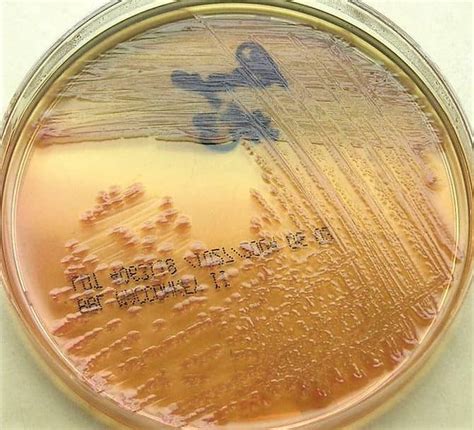 pseudomonas aeruginosa on macconkey agar